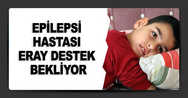 Epilepsi hastası Eray destek bekliyor