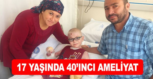 17 yaşında 40’ıncı ameliyat
